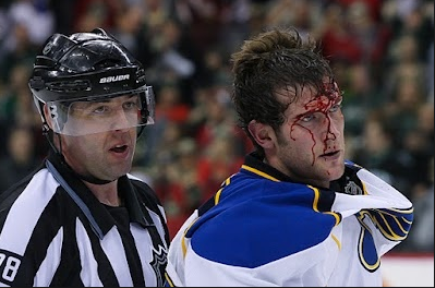  photo backes bloody_zpsiavrnf0r.png