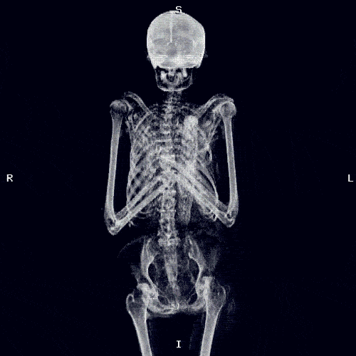 Skeleton X-ray GIF, Skeleton x-ray in 3D